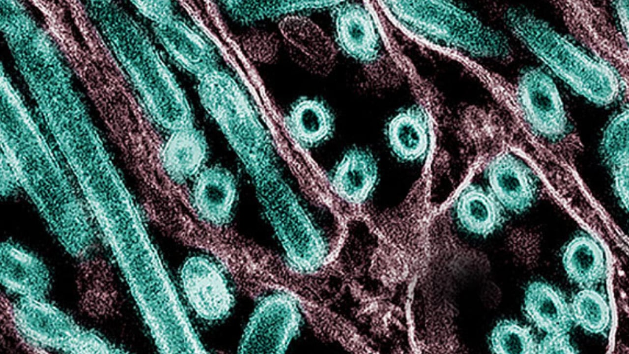 Harvard scientists warn of bird flu pandemic
