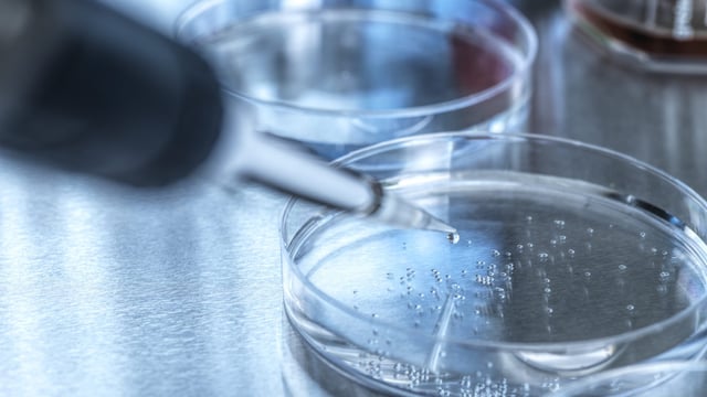 Second case of foot-and-mouth disease in Germany ruled out